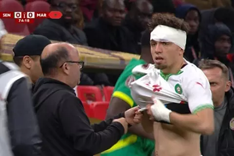 بسبب إصابة العيناوي.. توقف مباراة السنغال والمغرب لمدة 6 دقائق في نهائي كأس أمم أفريقيا